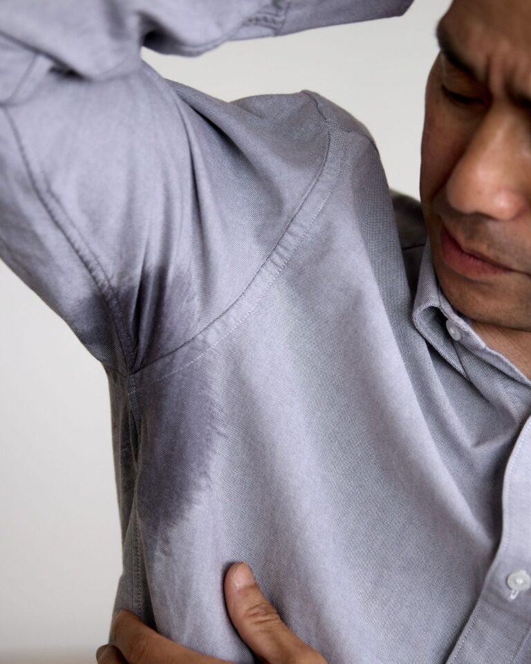 Person with Hyperhidrosis or excessive sweating - PURE Medical Spa